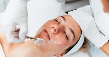 Beautician applying acid peel to young womans face