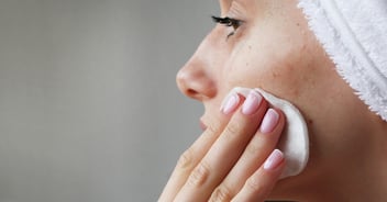 girl with acne on face putting treatment on