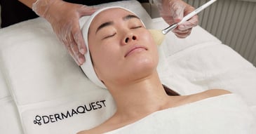 patient receiving chemical peel treatment from dermaquest specialist