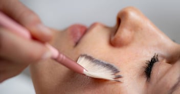 woman receiving chemical peel on face