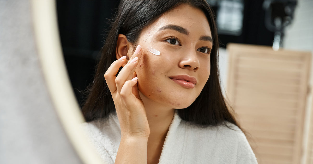 asian woman applying acne treatment cream and looking at mirror