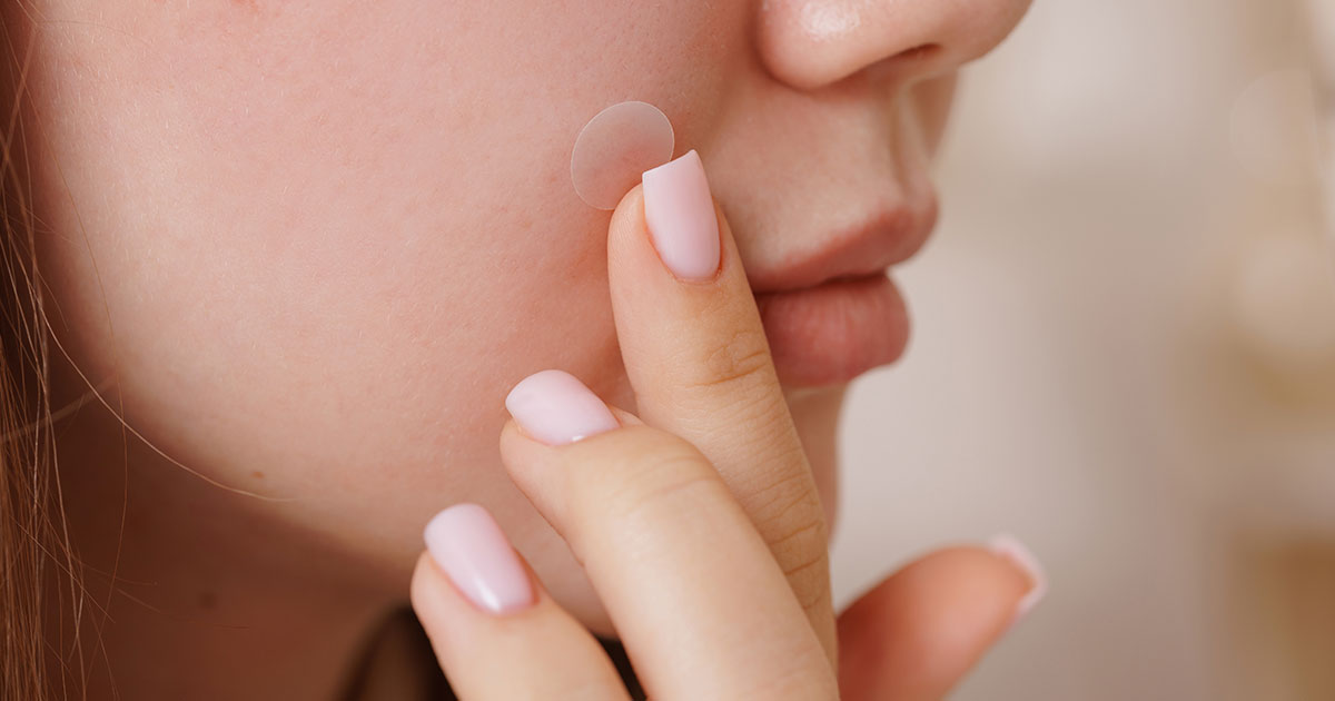 closeup of girl applying pimple patch to face
