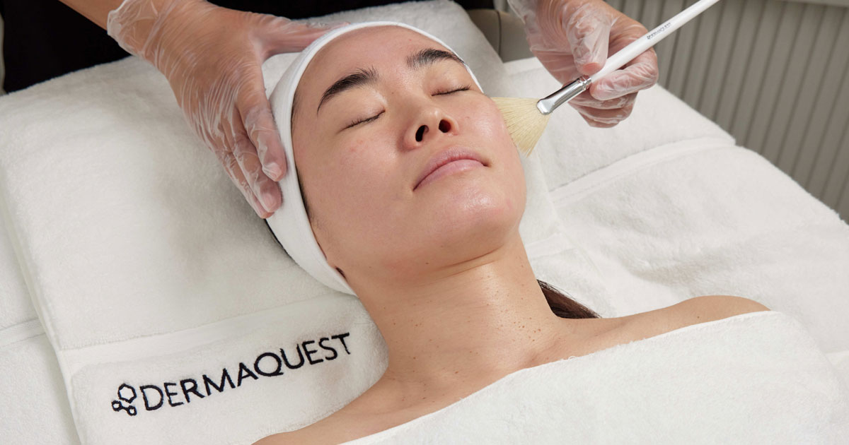 patient receiving chemical peel treatment from dermaquest specialist