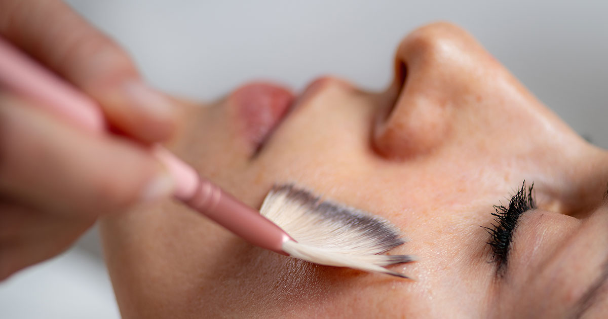 woman receiving chemical peel on face